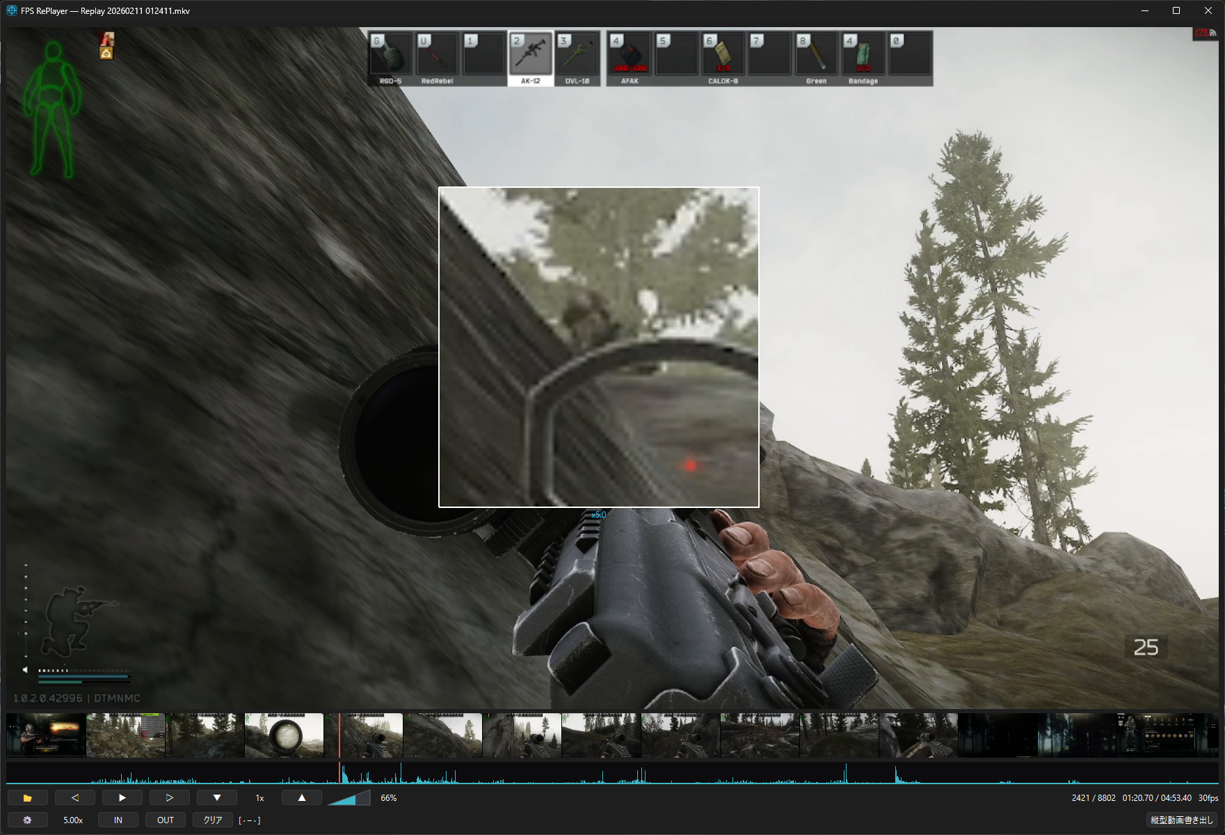 After magnifier
